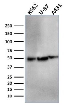 ATG5 Antibody (ATG5/2553) - Azide and BSA Free, Novus Biologicals 100 &mu;g | Buy Online | Novus Biologicals | Fisher Scientific